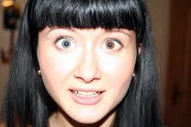 heterochromia iridium