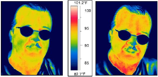 thermogram