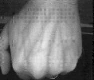 Vue infrarouge du dos de la main