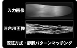 Réseau veineux du doigt