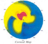 corneal map