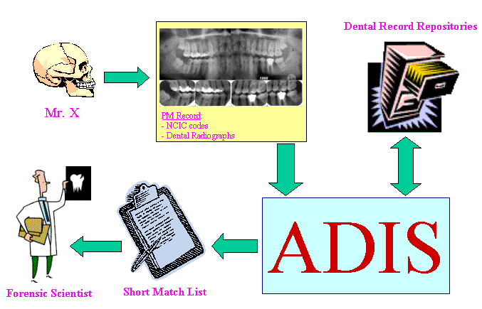 Syst�me automatique d'identification de la dentition