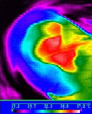 Image infra-rouge d'une oreille